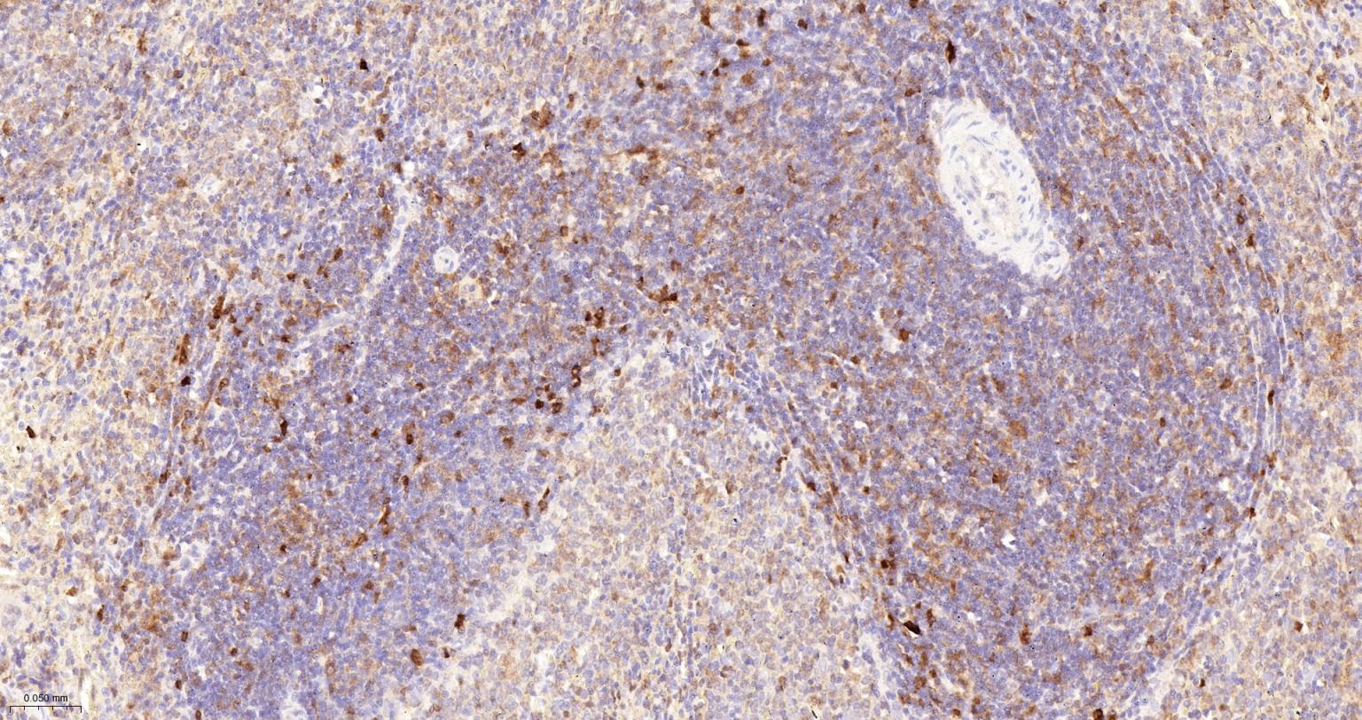 活化半胱胺酸蛋白酶蛋白-3重组兔单抗