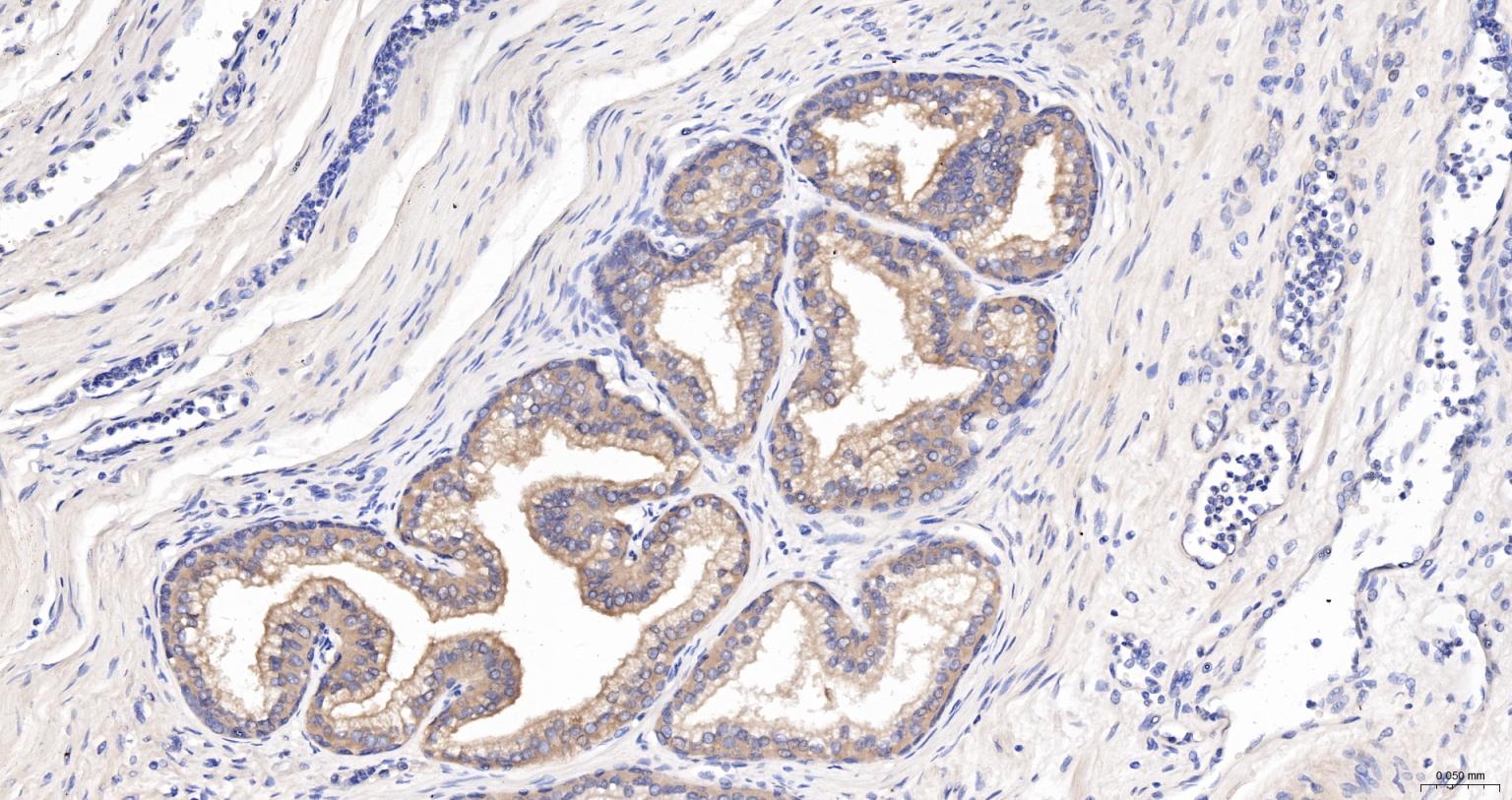 PSA(Pa3) Mouse mAb (一抗) | Bioss
