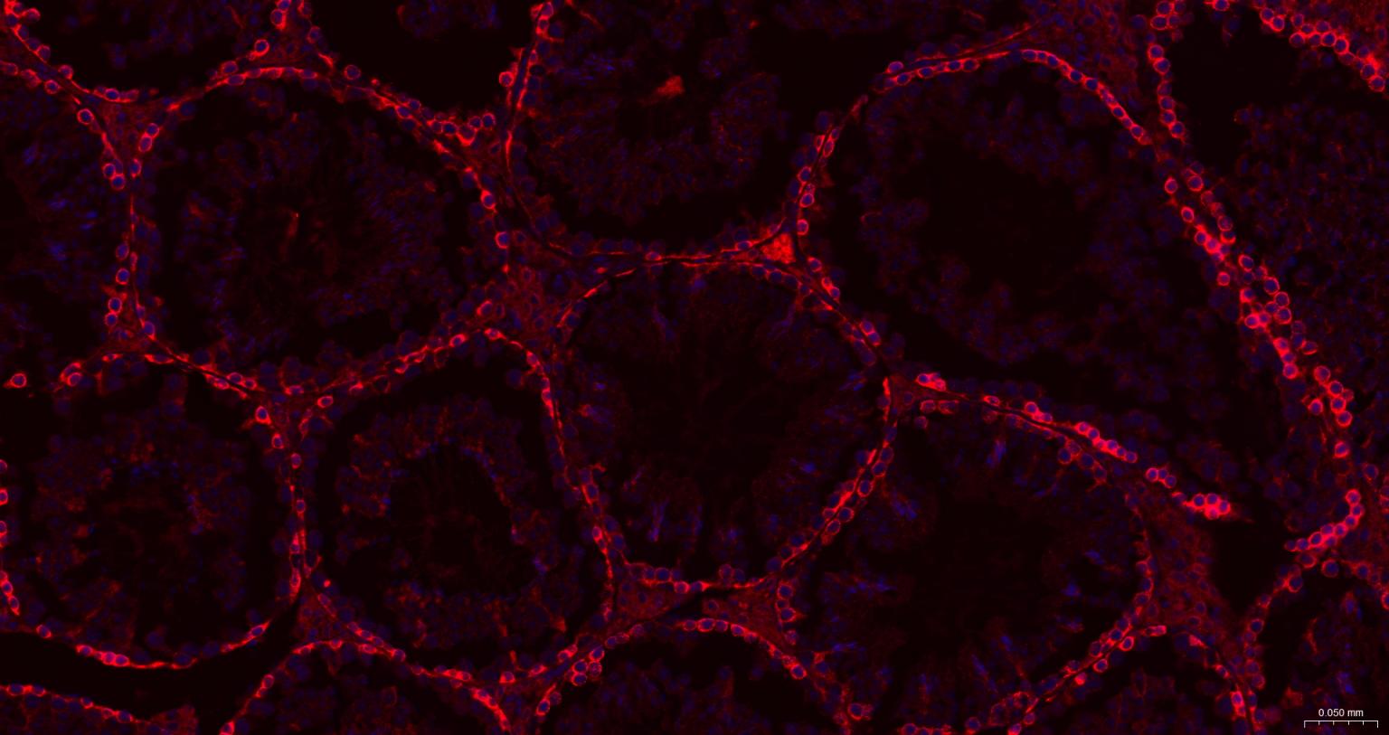 甘氨酰胺核苷酸合成酶重组兔单抗