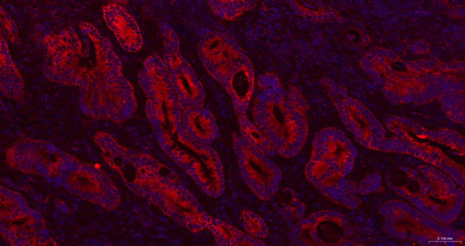 甘氨酰胺核苷酸合成酶重组兔单抗
