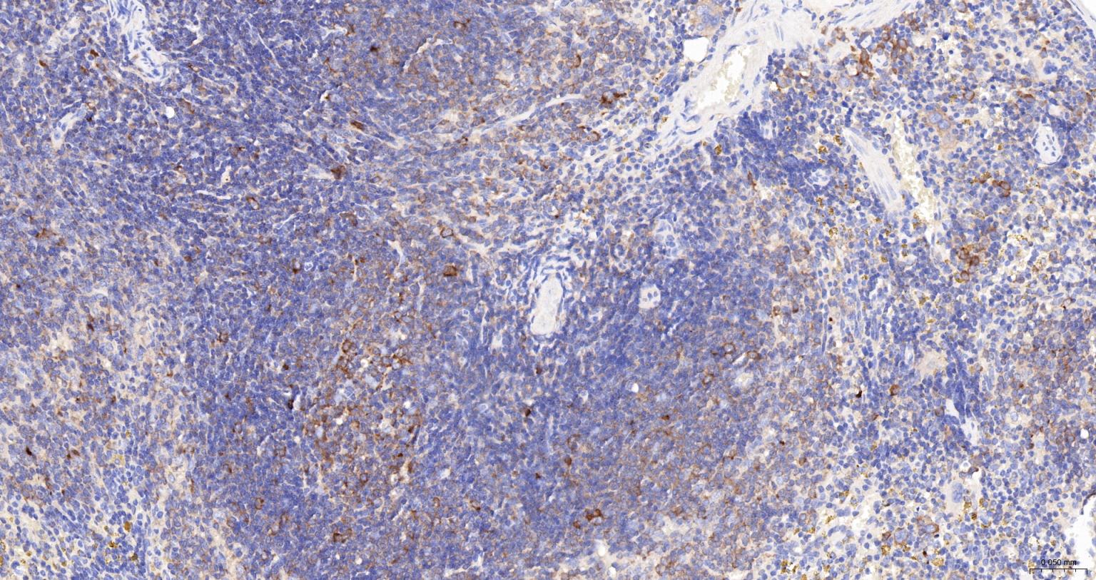 甘氨酰胺核苷酸合成酶重组兔单抗
