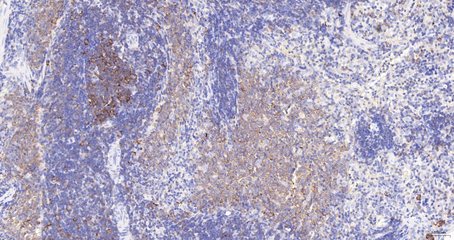 甘氨酰胺核苷酸合成酶重组兔单抗