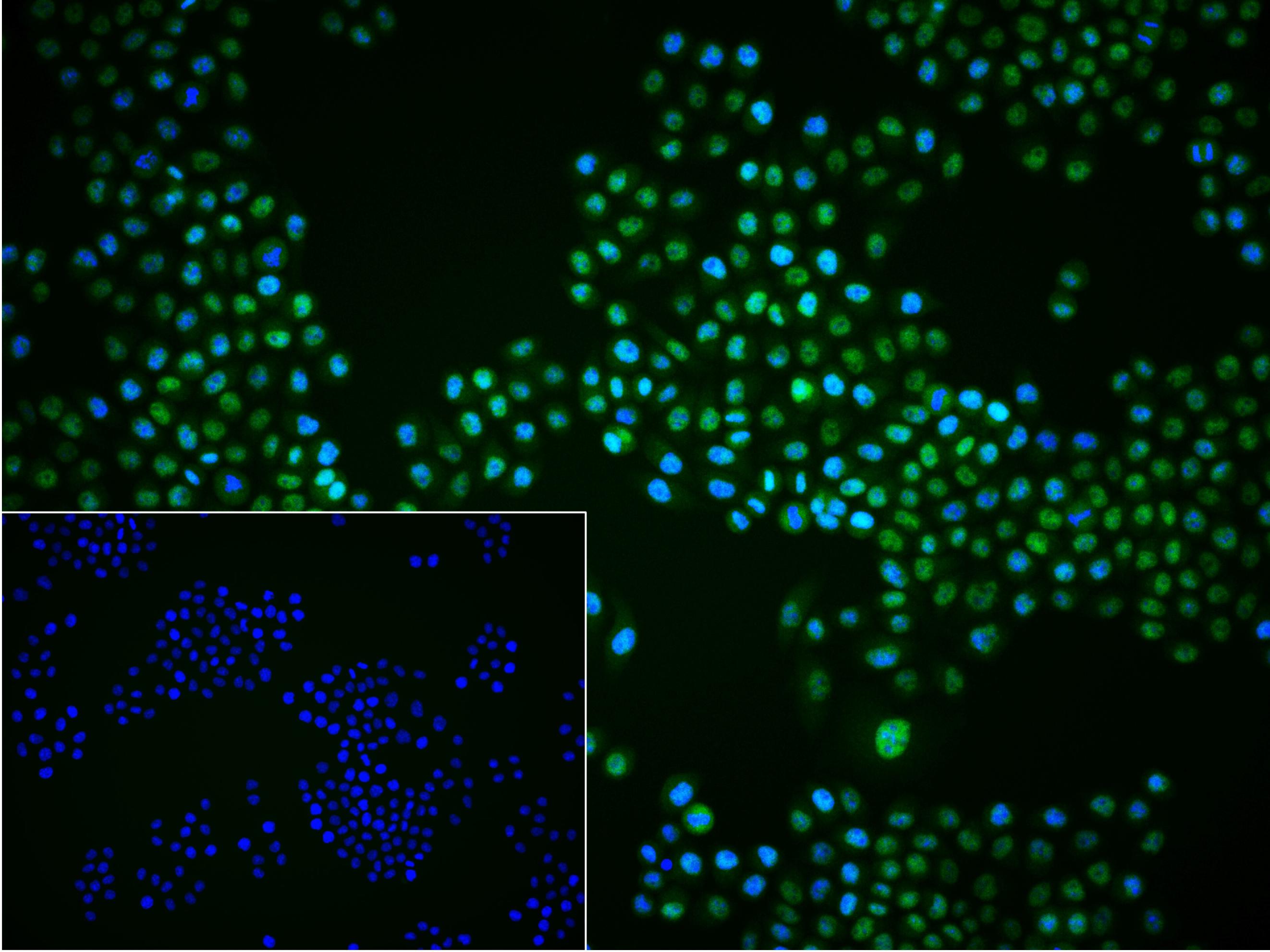 BRD2蛋白重组兔单抗