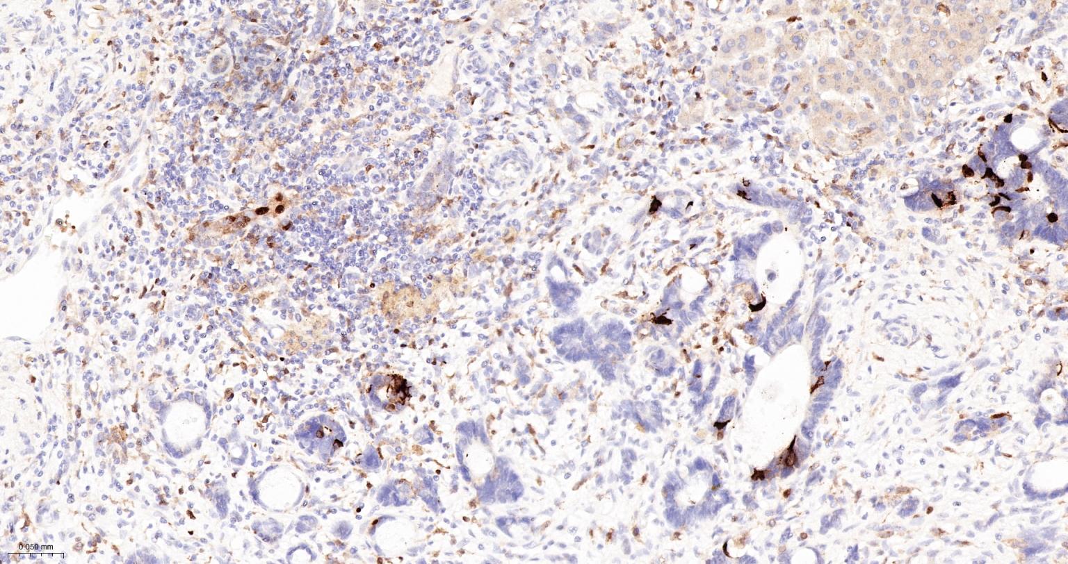 5-脂氧合酶重组兔单抗