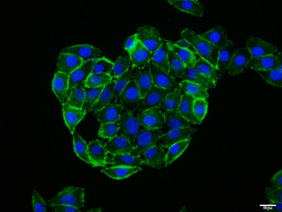 细胞表面趋化因子受体7重组兔单抗