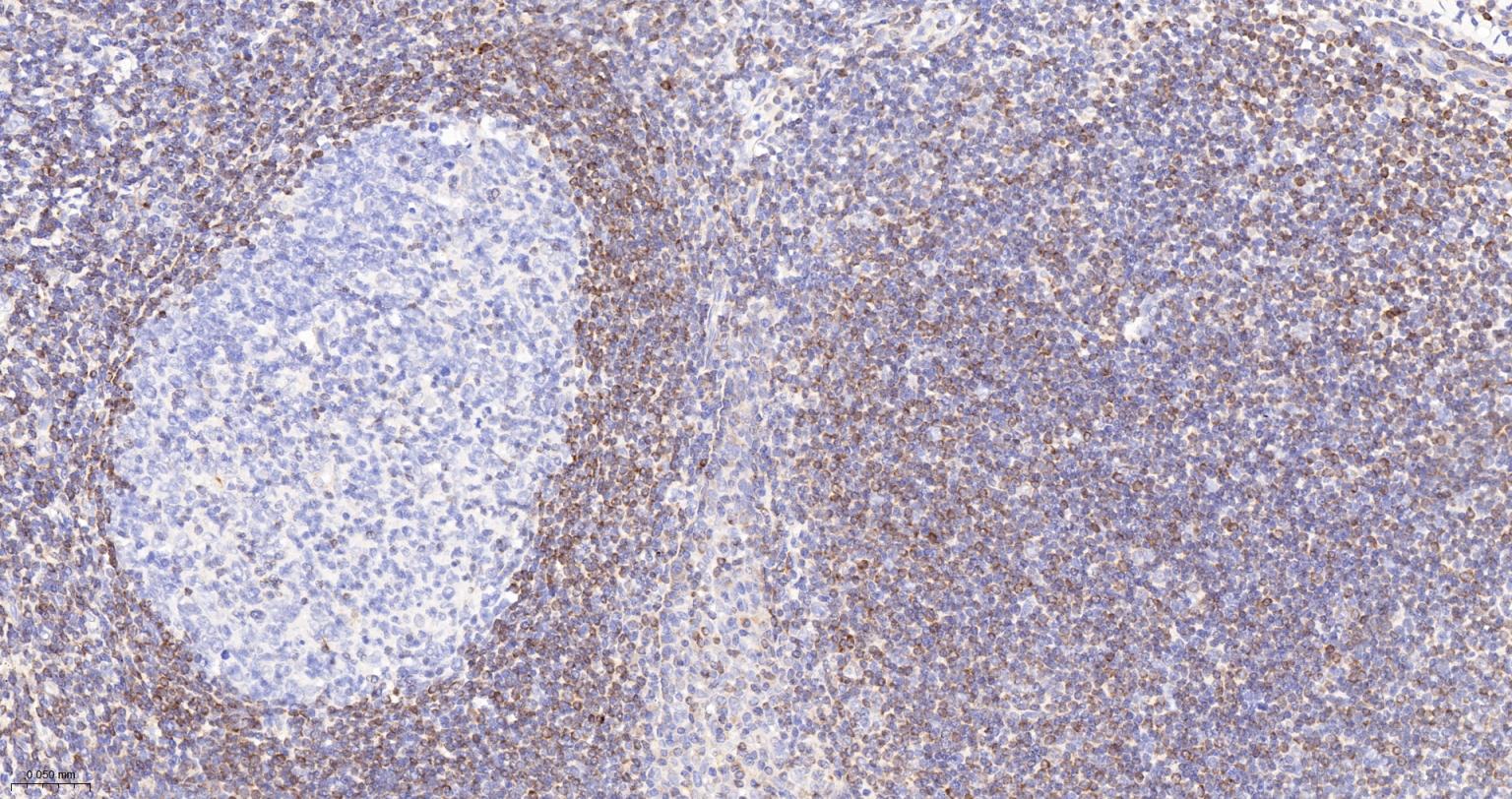 Bcl-2抗体-bs-0032R