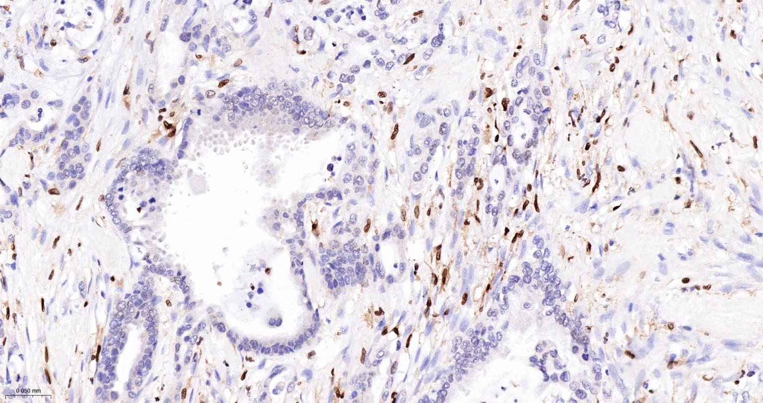 5-脂氧合酶重组兔单抗