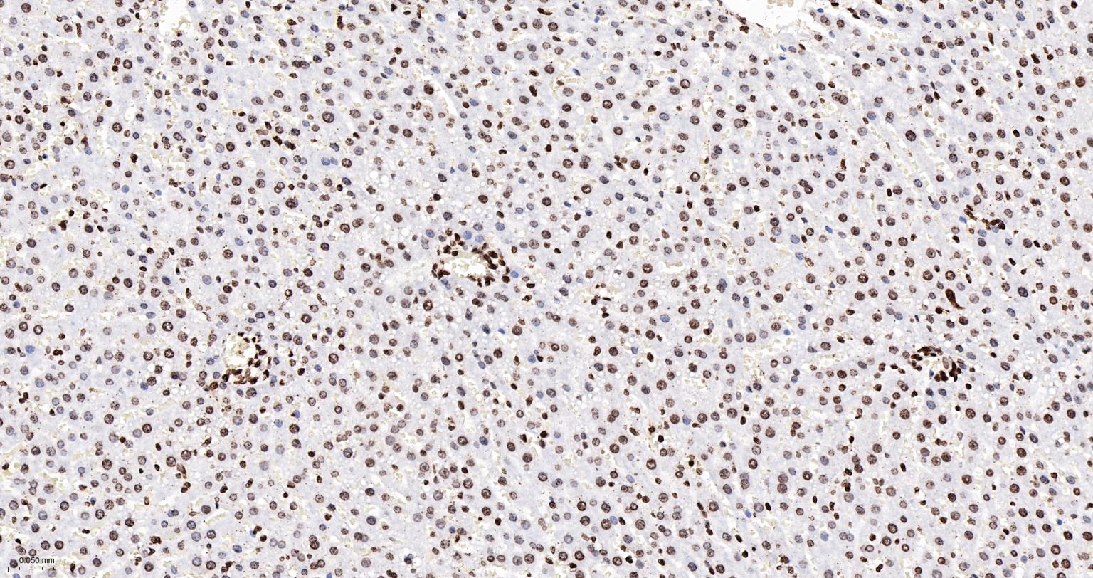 组蛋白H4重组兔单抗