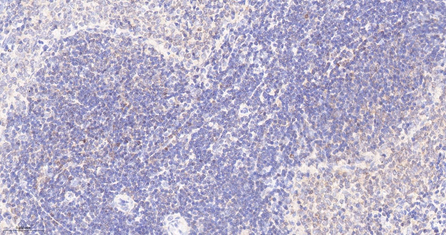 Bcl-2抗体-bs-0032R