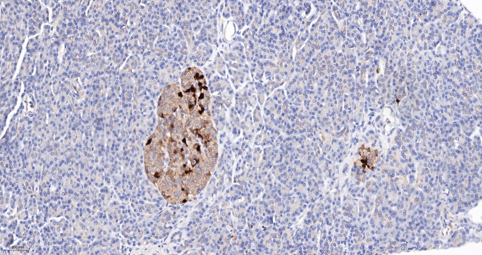 钙结合蛋白D28K重组兔单抗