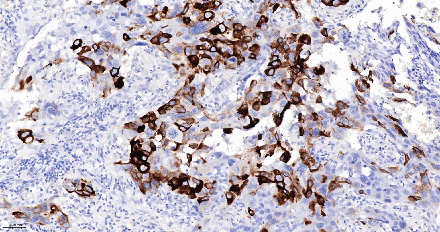 细胞角蛋白5重组兔单抗