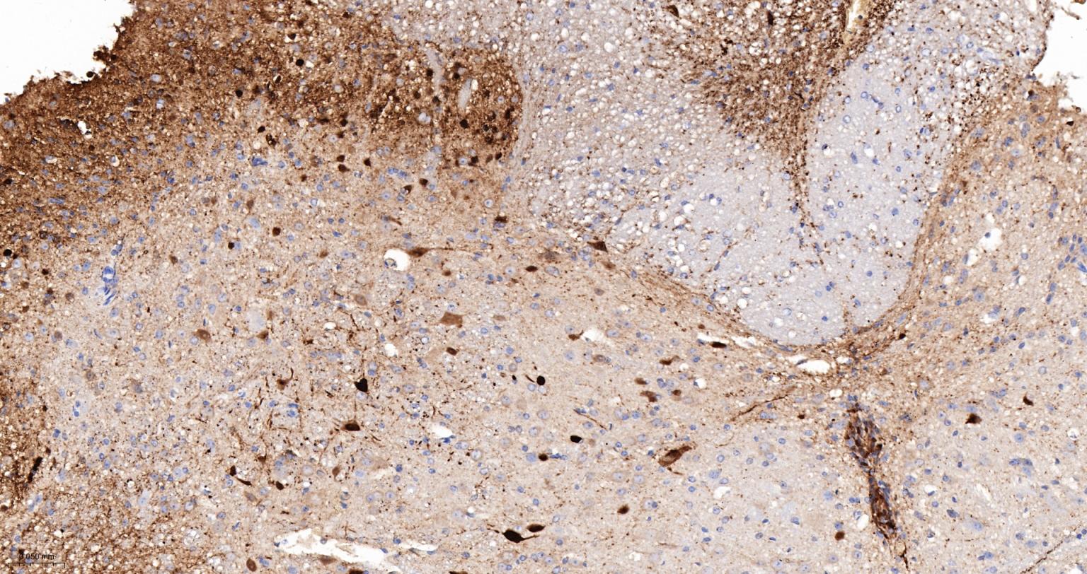 钙结合蛋白D28K重组兔单抗