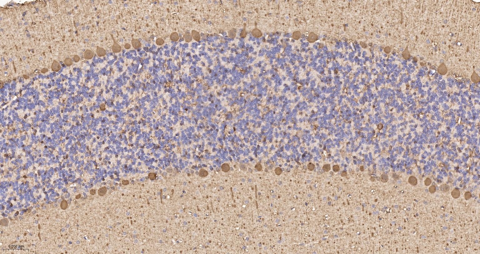 钙结合蛋白D28K重组兔单抗