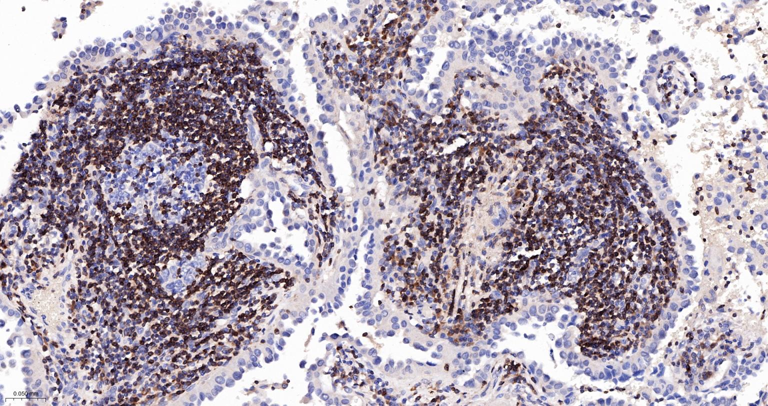 Bcl-2抗体-bs-0032R