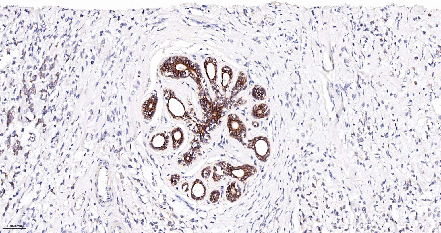 Bcl-2抗体-bs-0032R