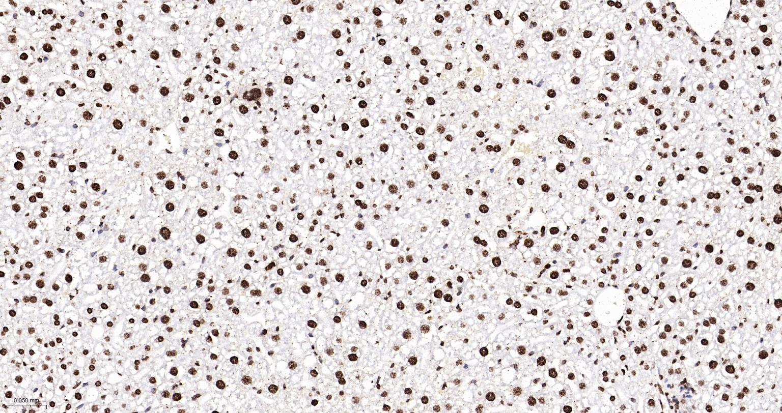 组蛋白H4重组兔单抗