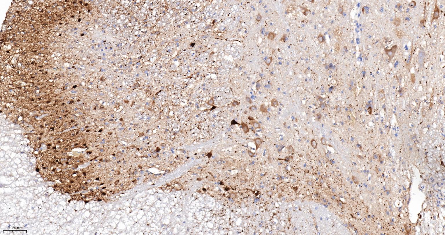 钙结合蛋白D28K重组兔单抗