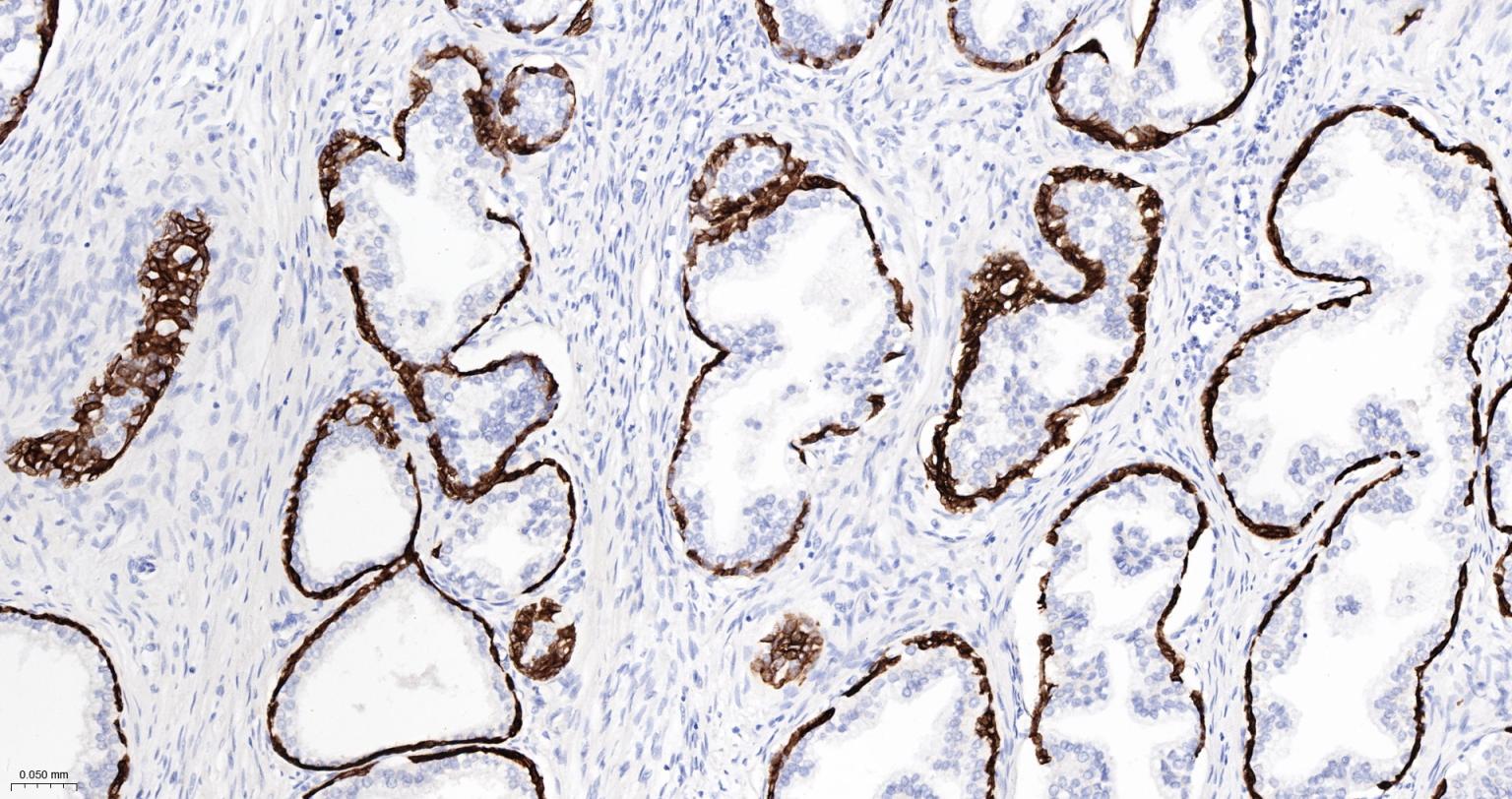 细胞角蛋白5重组兔单抗