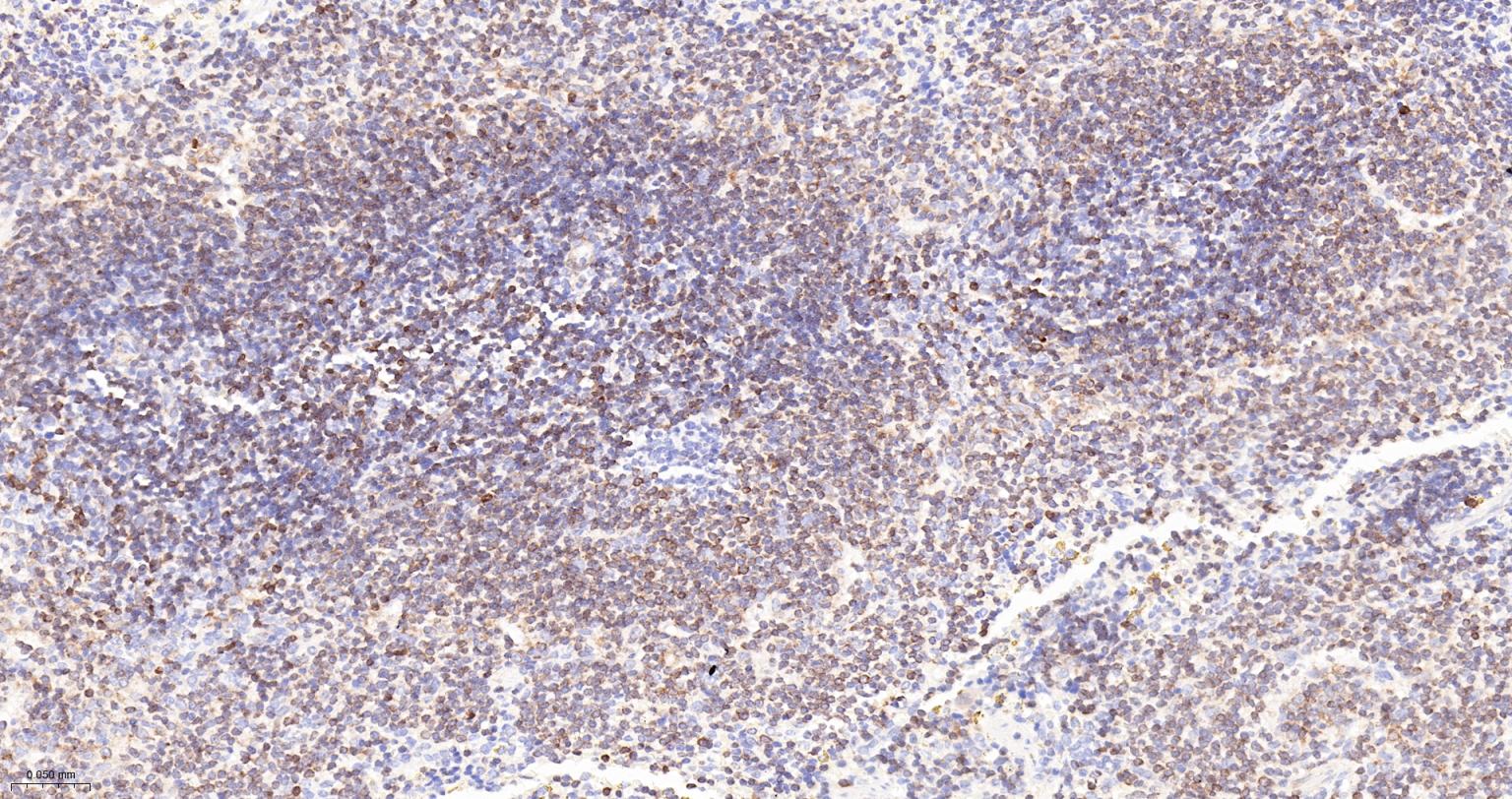 Bcl-2抗体-bs-0032R