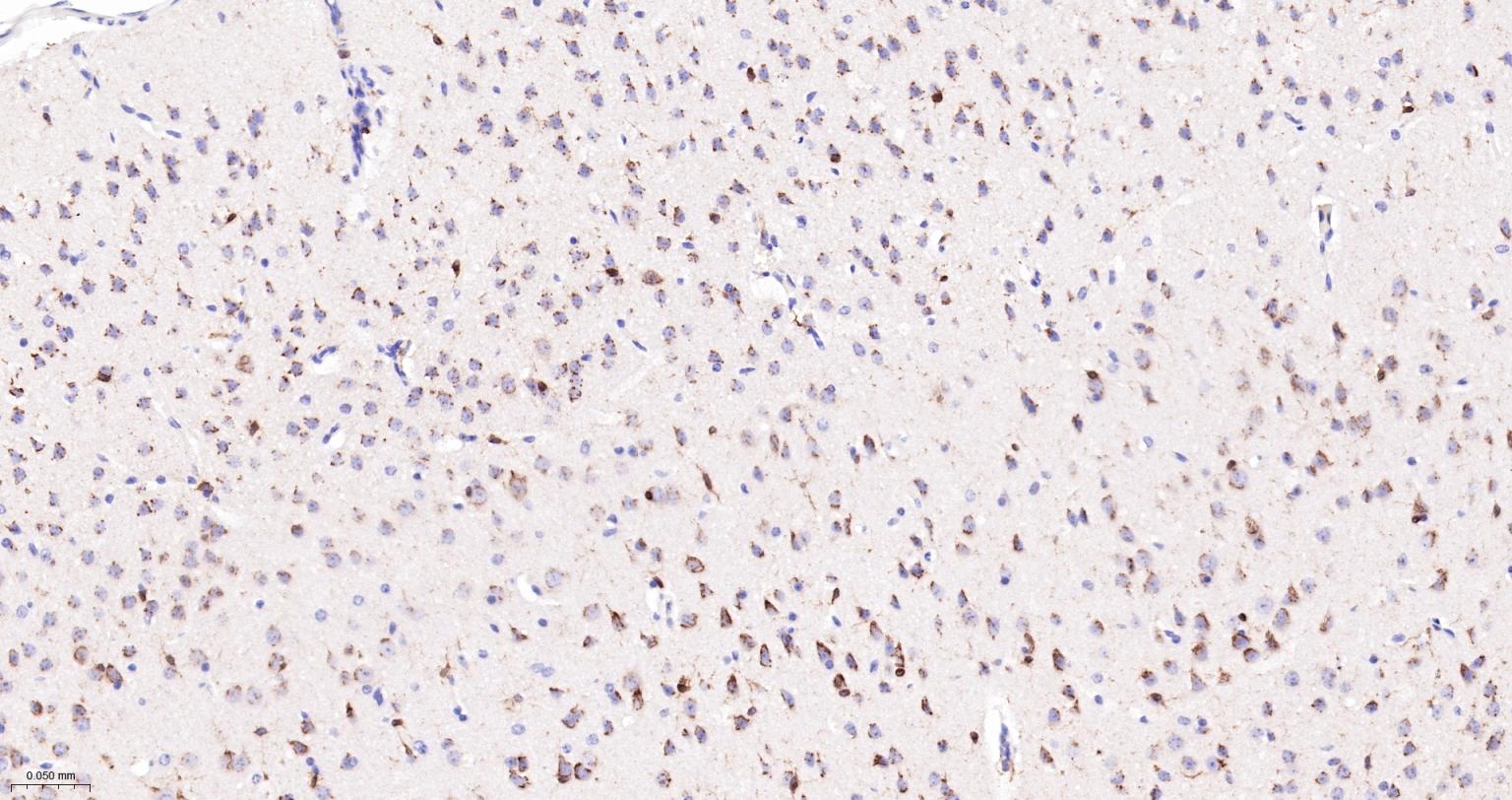 5-脂氧合酶重组兔单抗