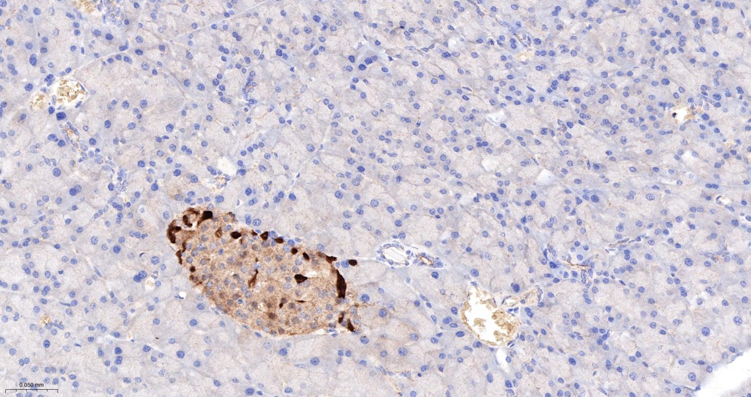 钙结合蛋白D28K重组兔单抗