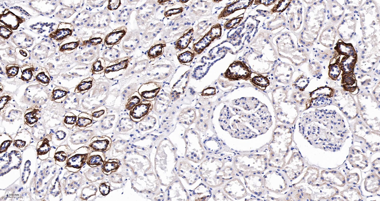 核突触蛋白-α重组兔单抗