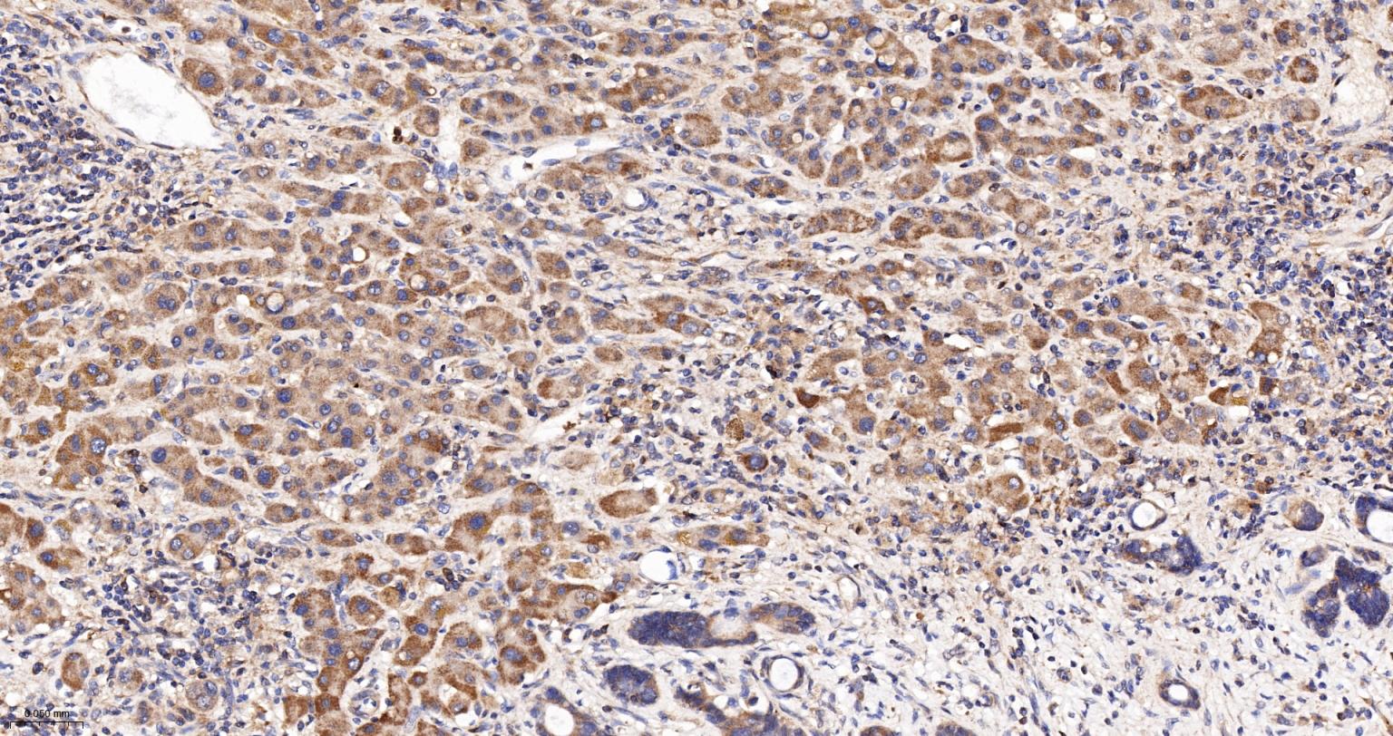 活化半胱胺酸蛋白酶蛋白-3重组兔单抗