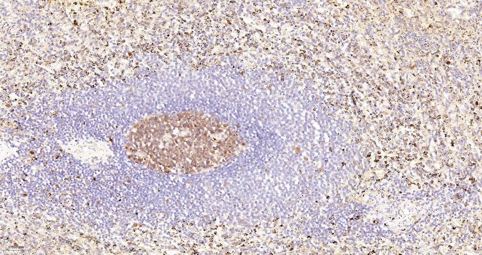 活化半胱胺酸蛋白酶蛋白-3重组兔单抗