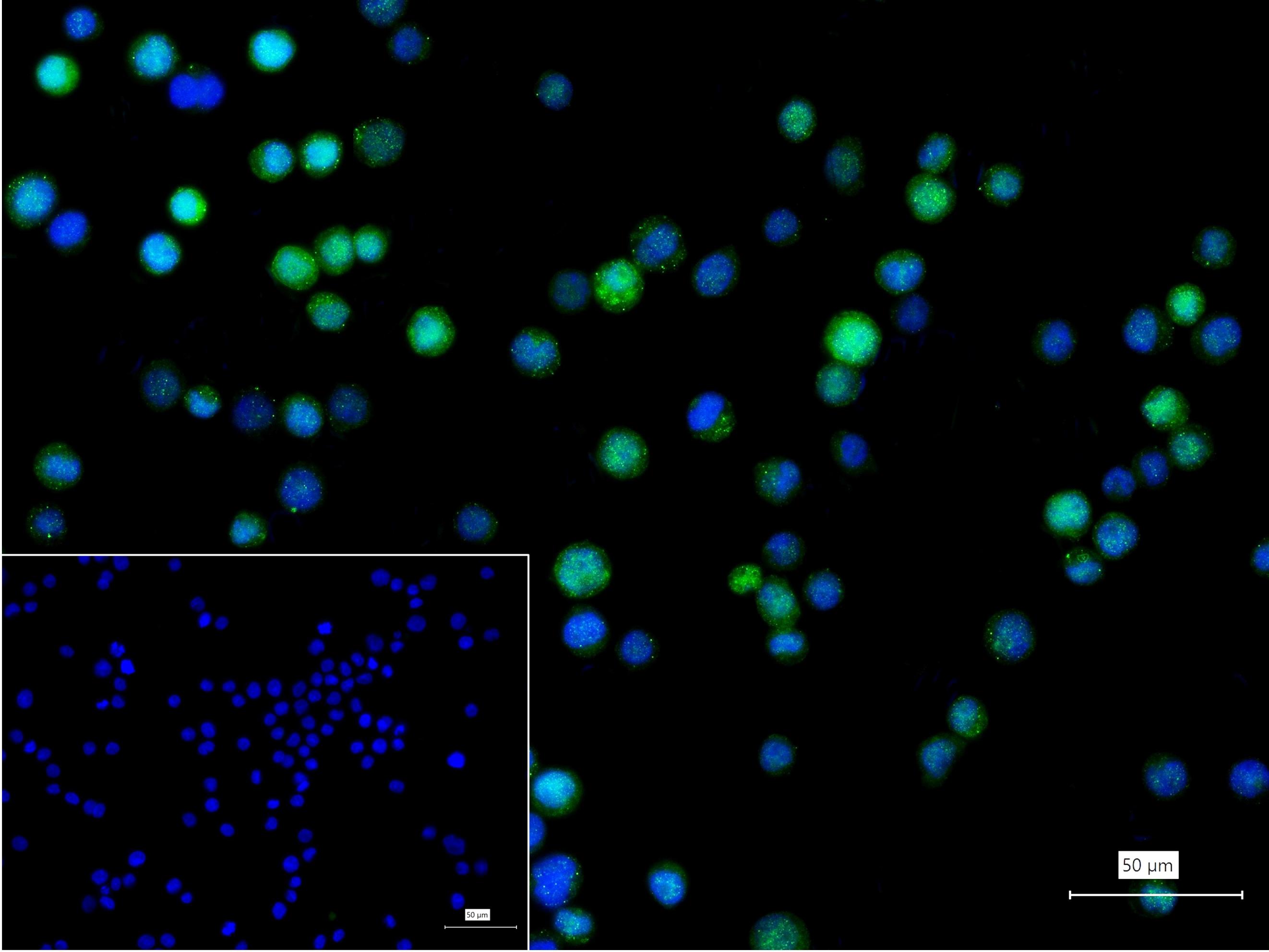 锌指蛋白Aiolos重组兔单抗-bsm-62807R