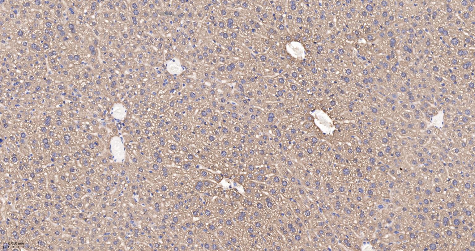 低密度脂蛋白受体相关蛋白1重组兔单抗