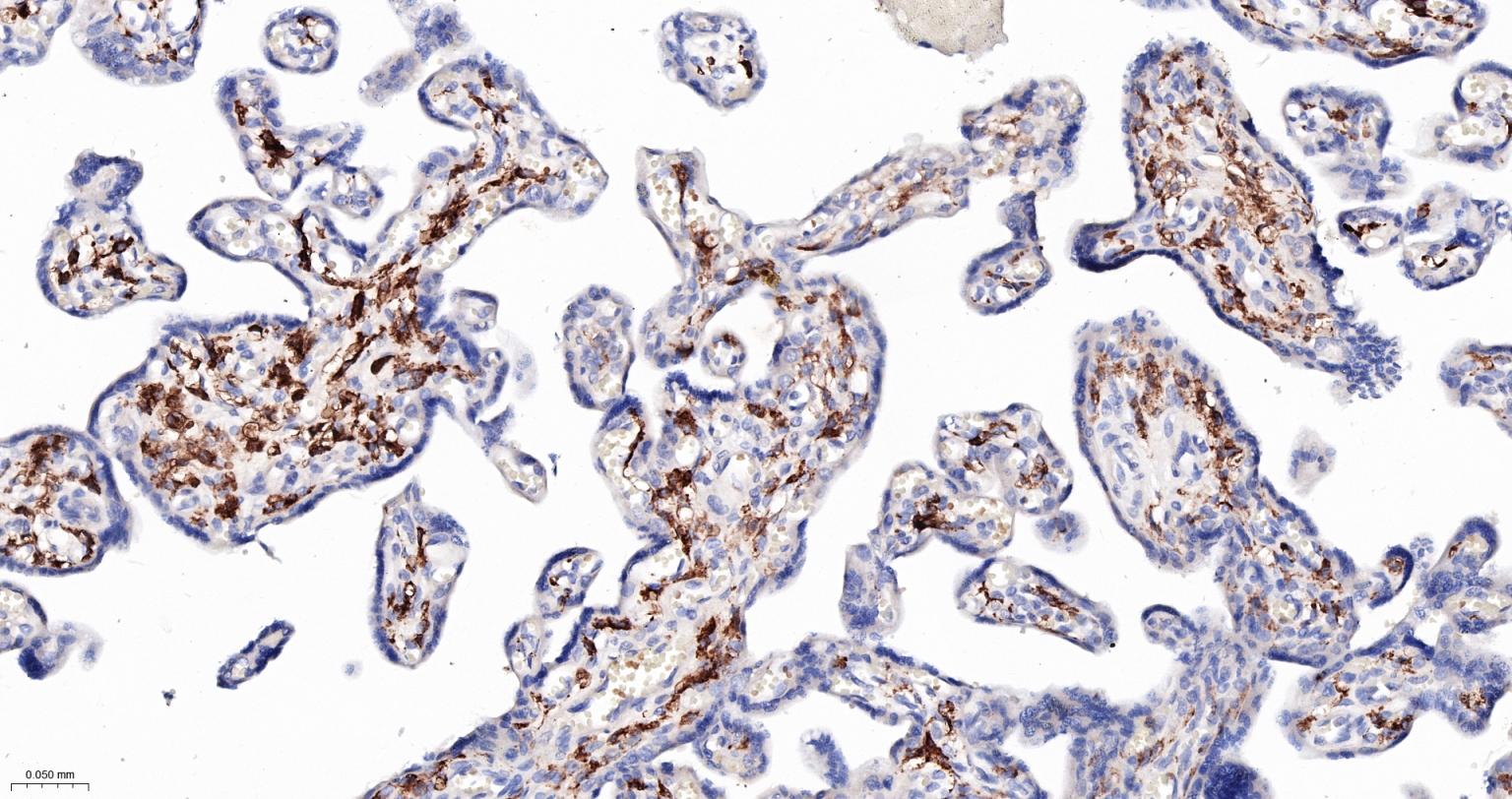 内毒素受体单克隆抗体-bsm-43686M