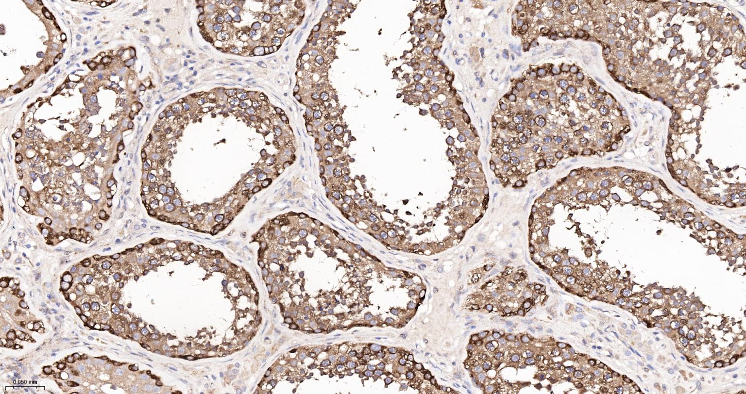 低密度脂蛋白受体相关蛋白1重组兔单抗