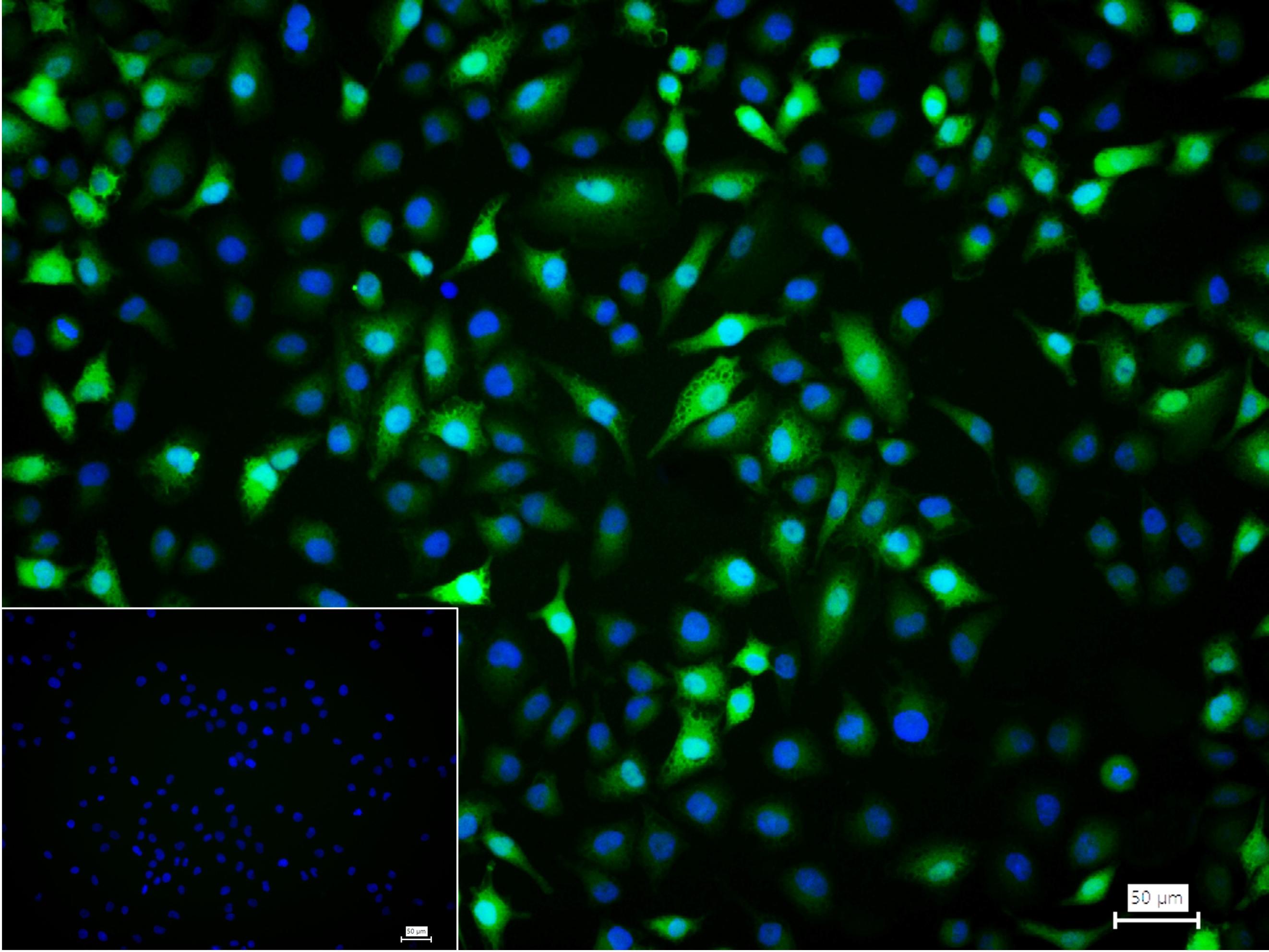 硫氧环蛋白还原酶1重组兔单抗