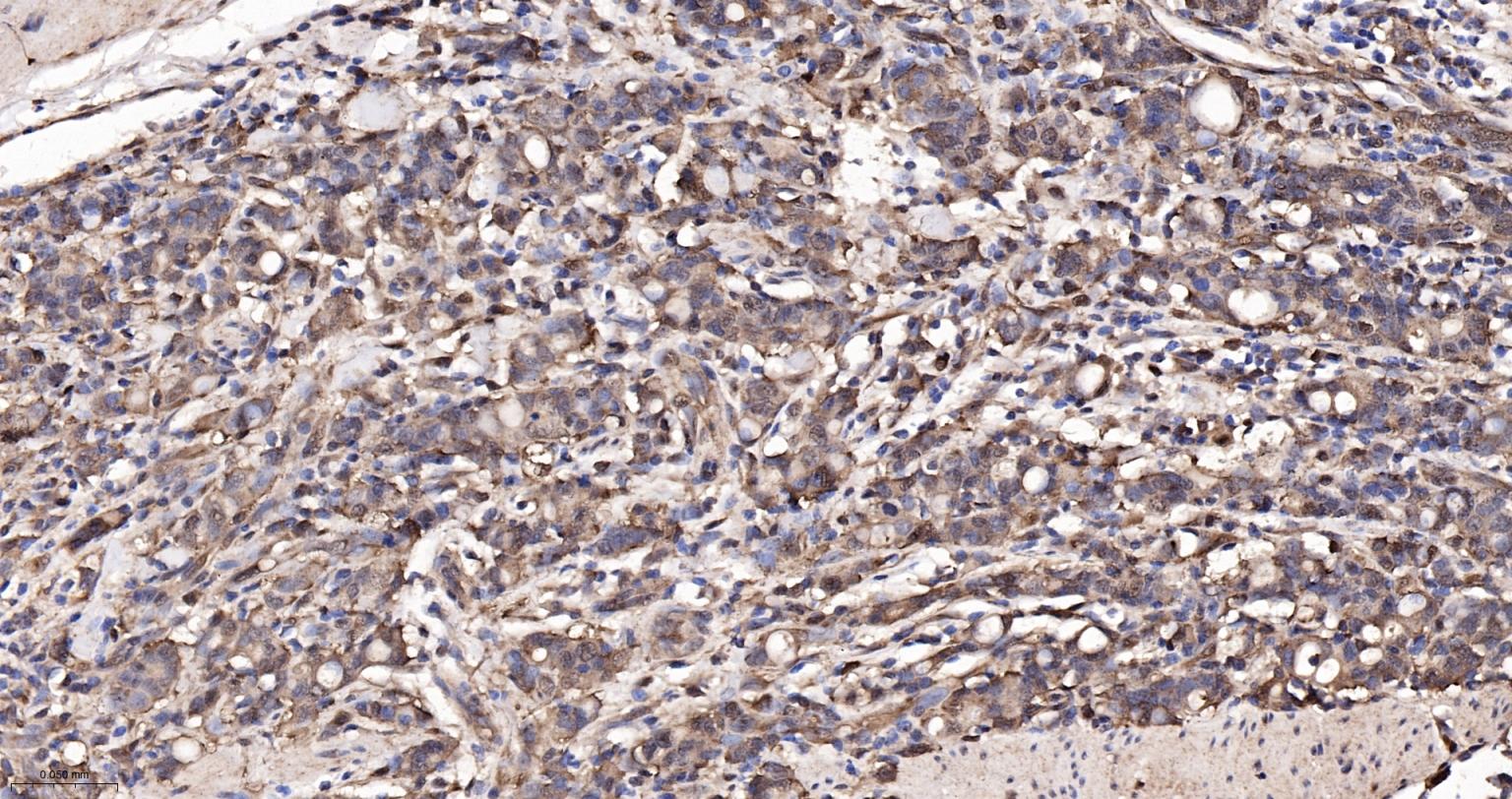 低密度脂蛋白受体相关蛋白1重组兔单抗
