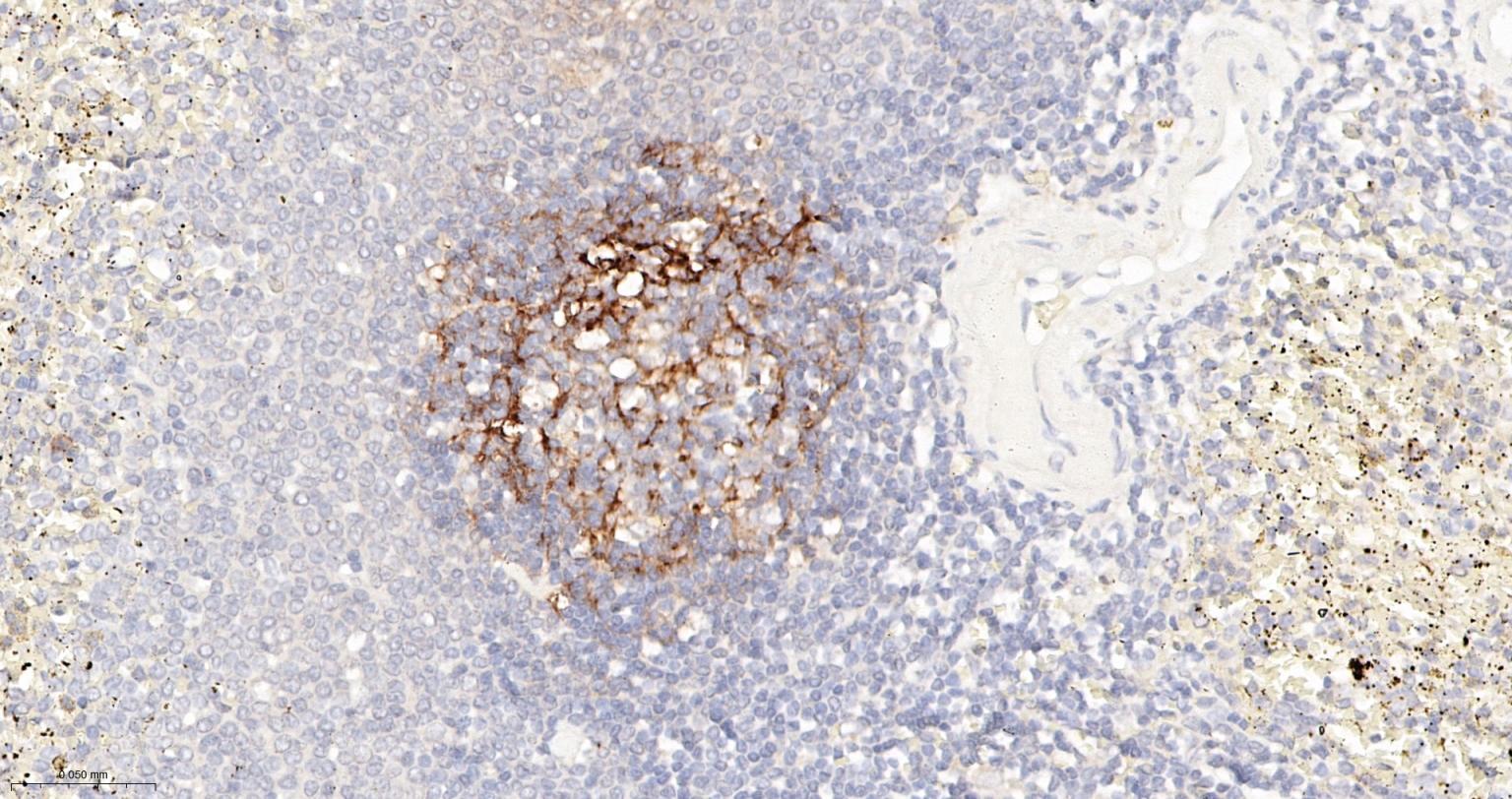 内毒素受体单克隆抗体-bsm-43686M