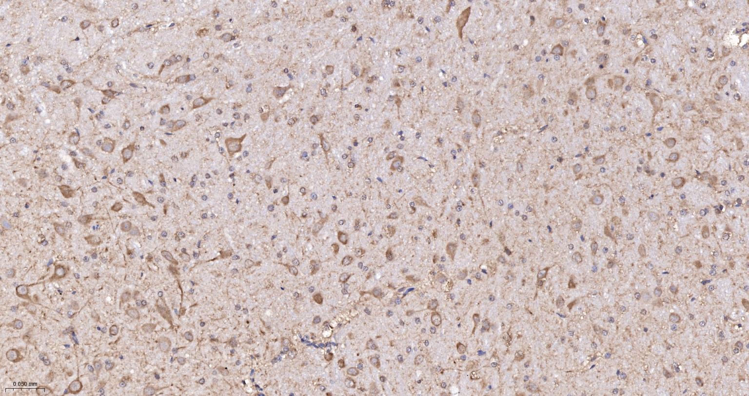 低密度脂蛋白受体相关蛋白1重组兔单抗