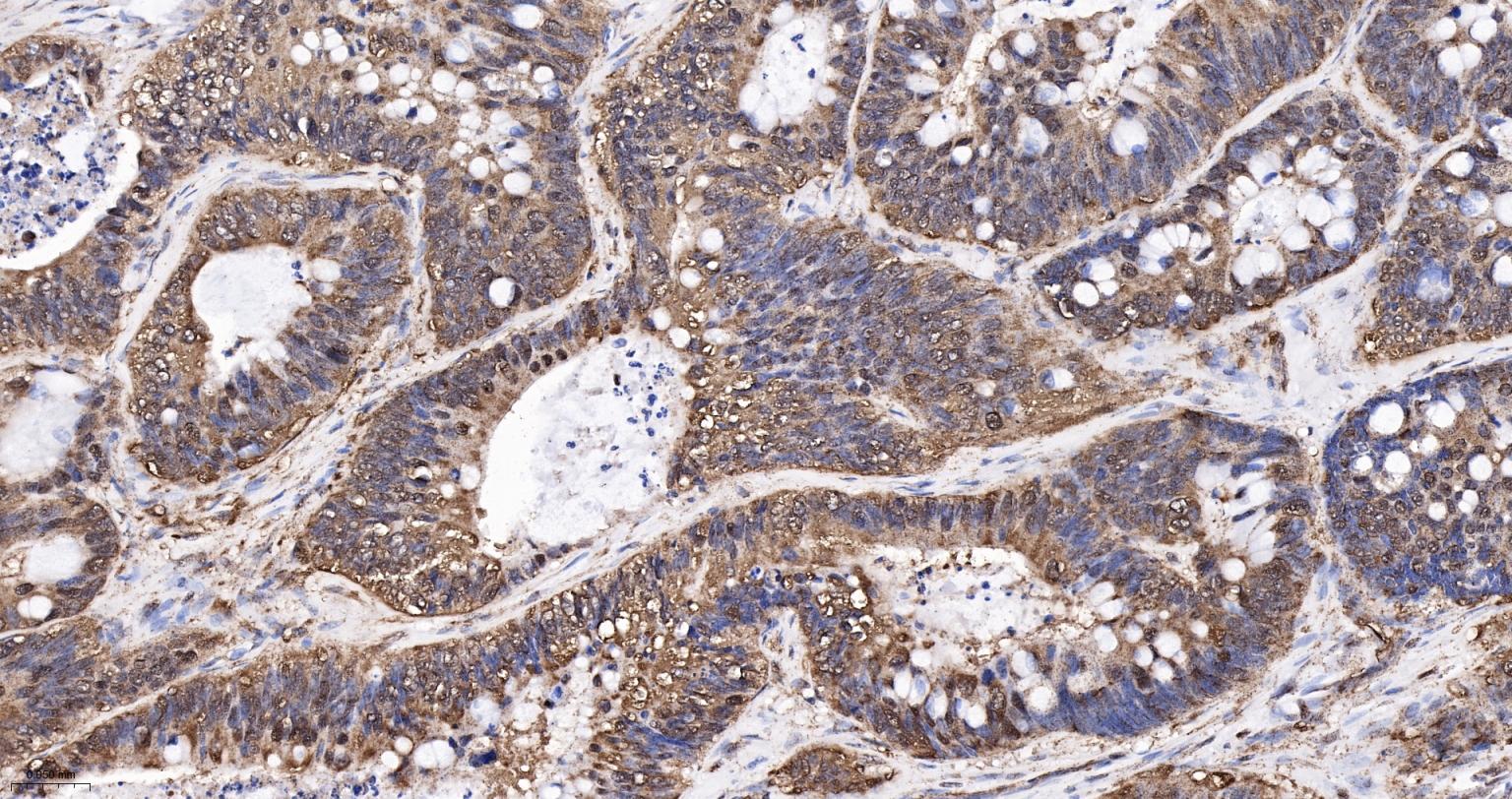 低密度脂蛋白受体相关蛋白1重组兔单抗