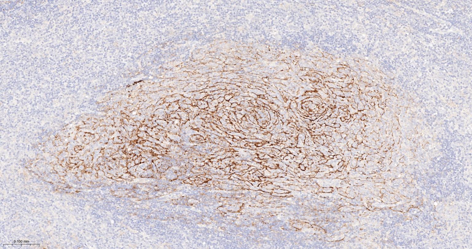 内毒素受体单克隆抗体-bsm-43686M
