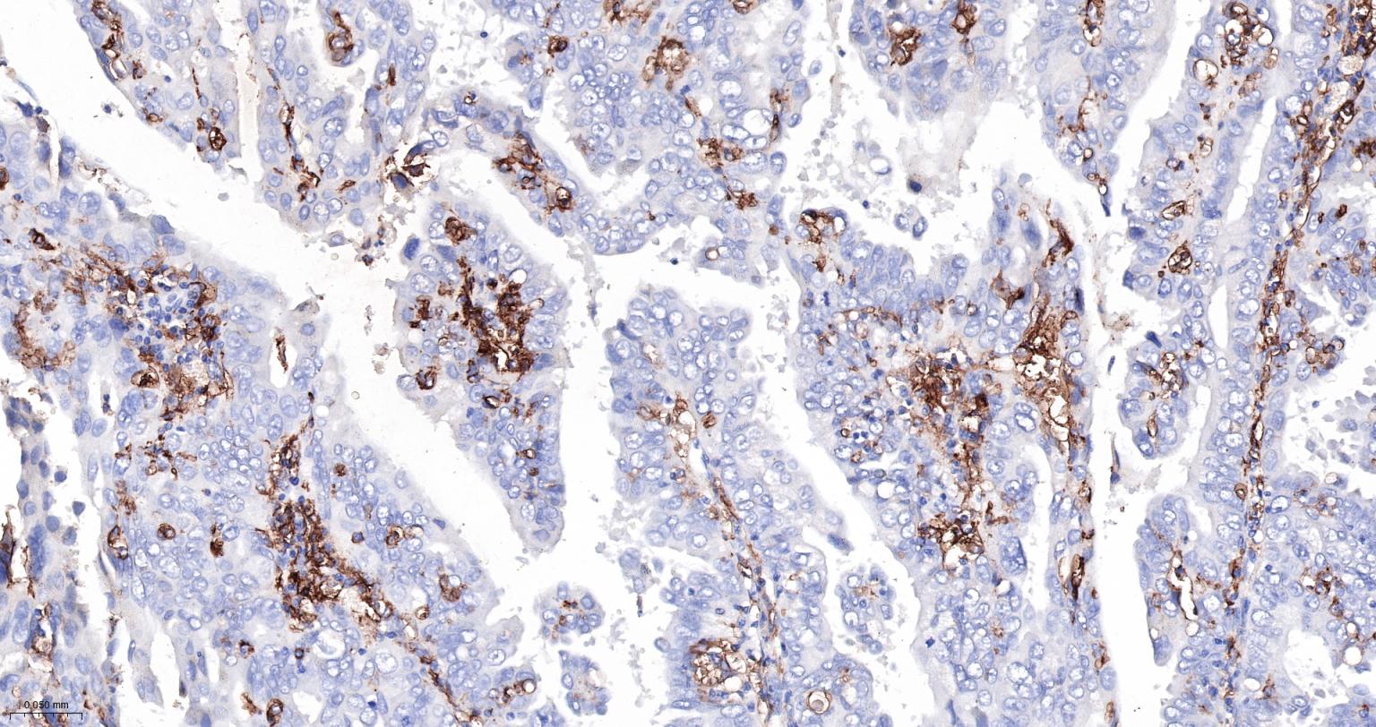 内毒素受体单克隆抗体-bsm-43686M