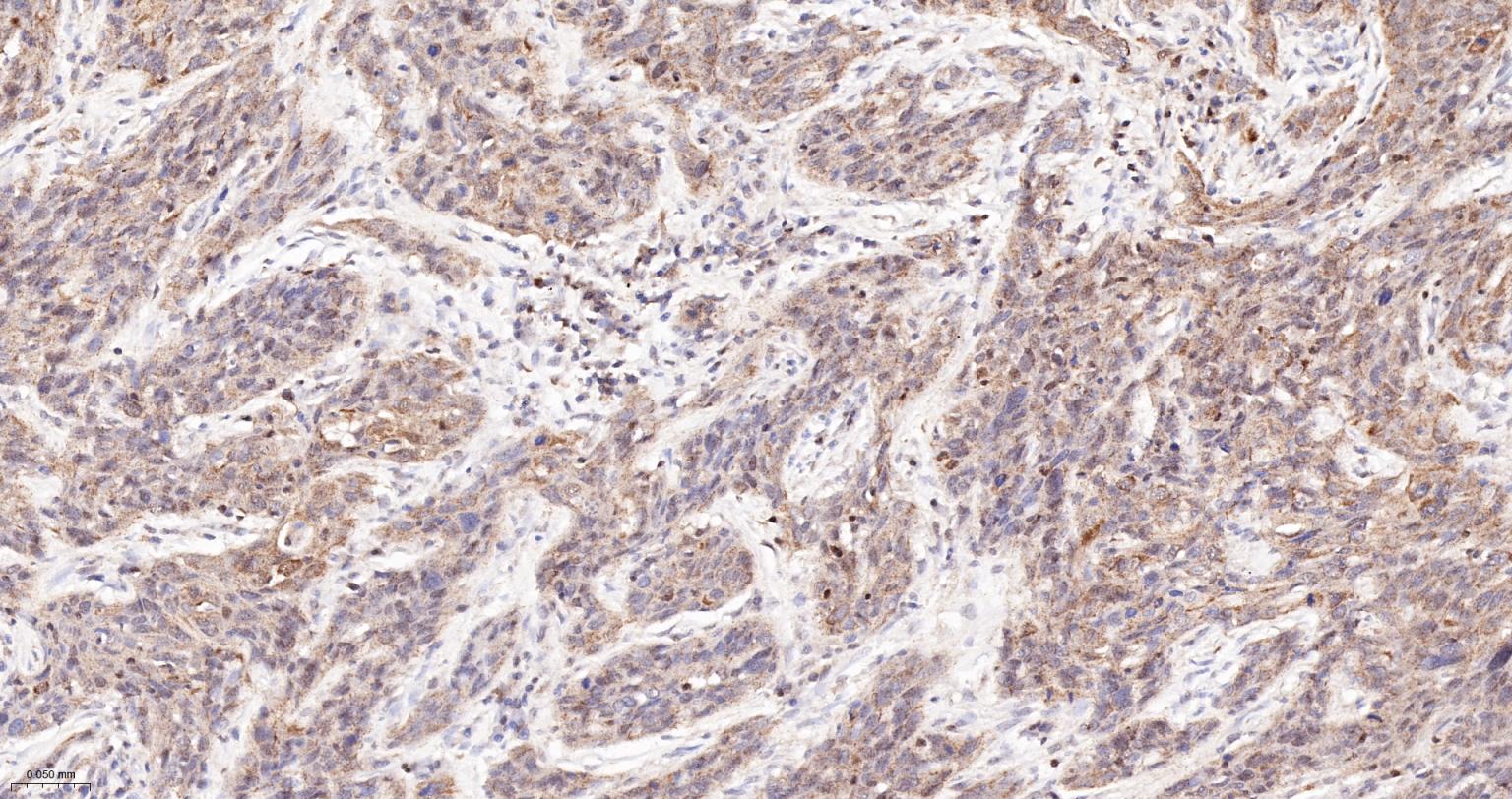 活化半胱胺酸蛋白酶蛋白-3重组兔单抗