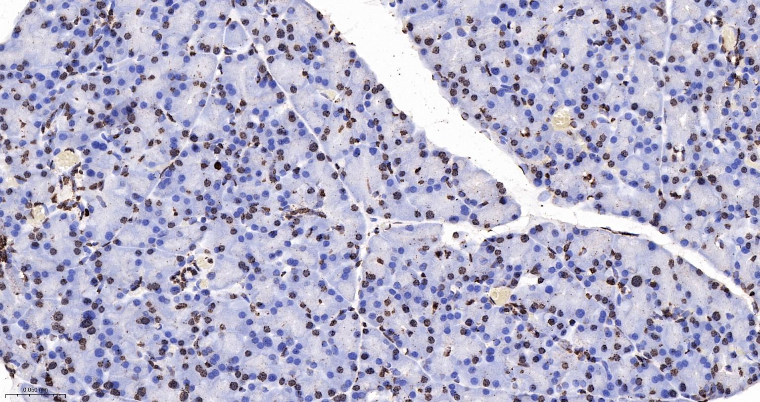 组蛋白H4重组兔单抗