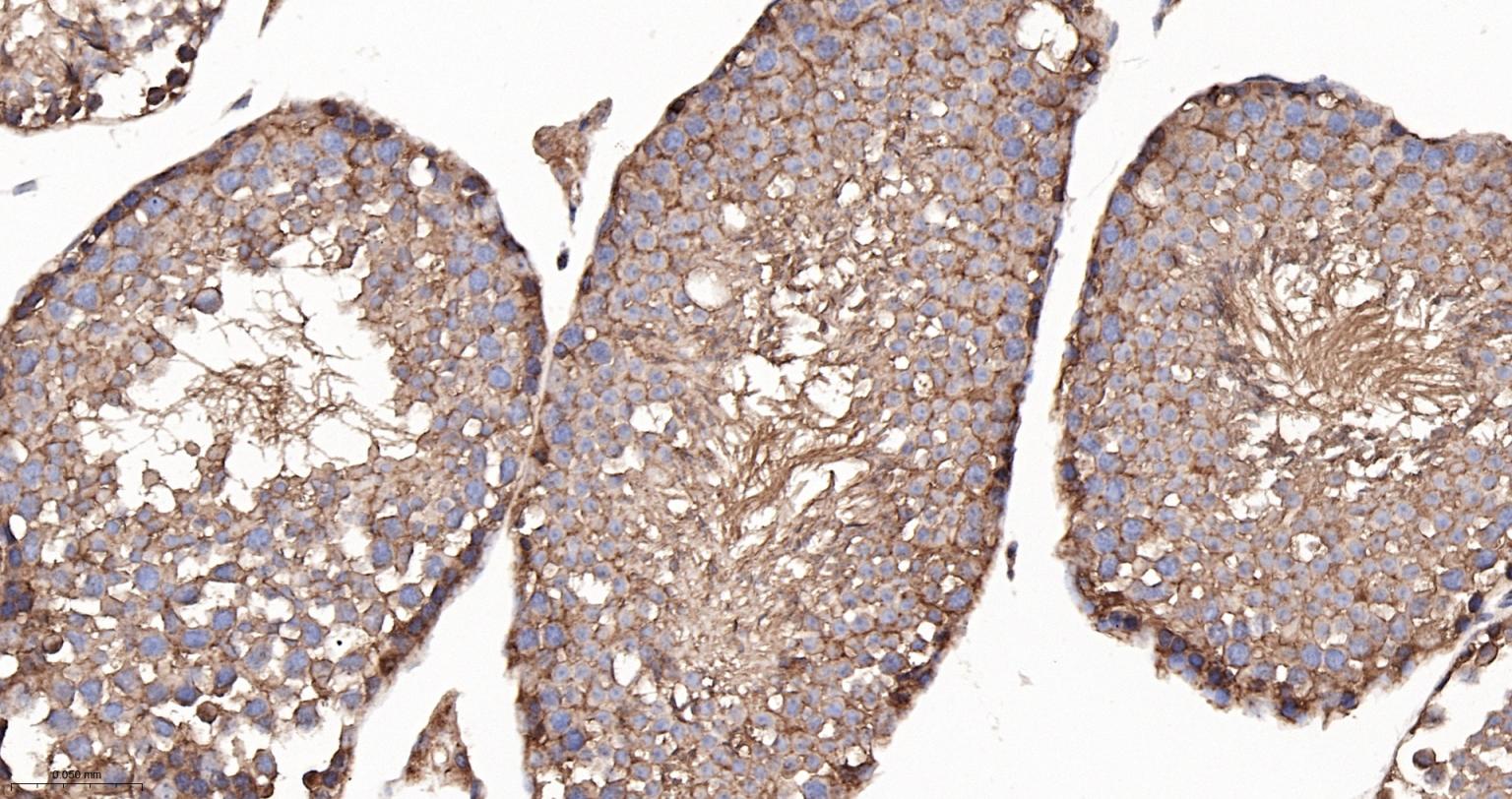 低密度脂蛋白受体相关蛋白1重组兔单抗