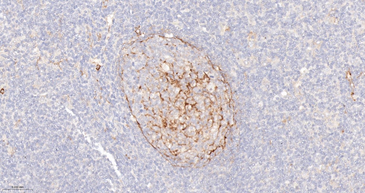 内毒素受体单克隆抗体-bsm-43686M