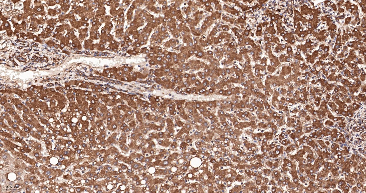 低密度脂蛋白受体相关蛋白1重组兔单抗
