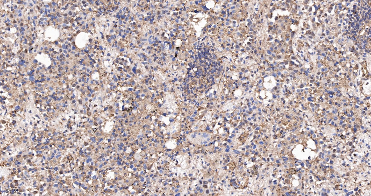 低密度脂蛋白受体相关蛋白1重组兔单抗