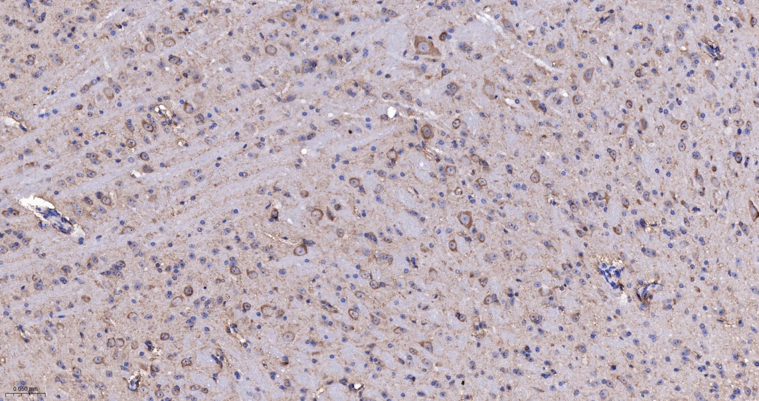 低密度脂蛋白受体相关蛋白1重组兔单抗