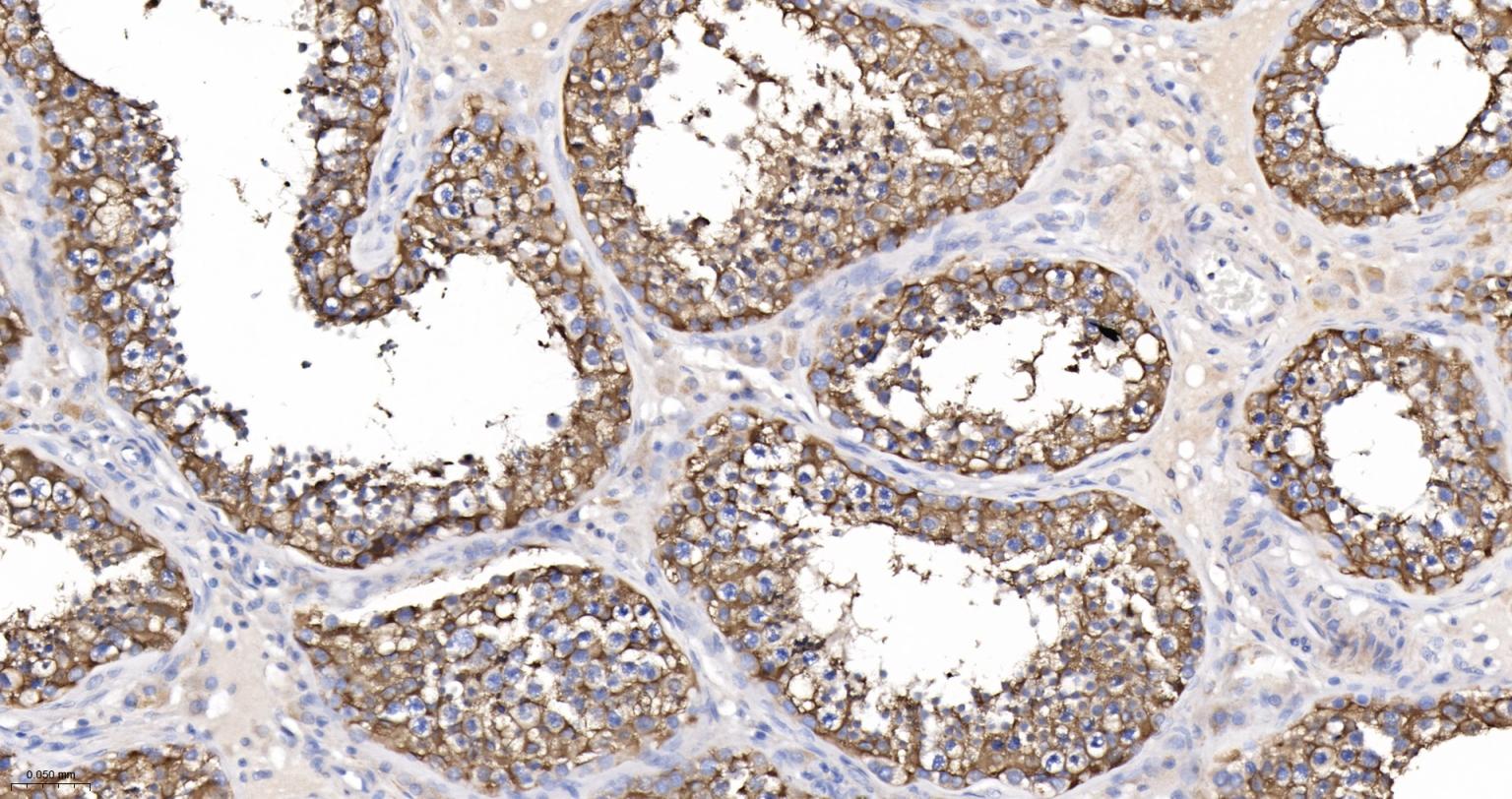 葡萄糖-6磷酸脱氢酶重组兔单抗