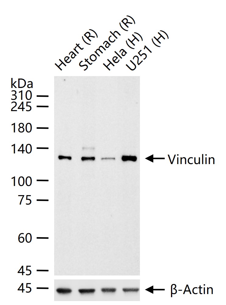 粘着斑蛋白（内参）重组兔单抗