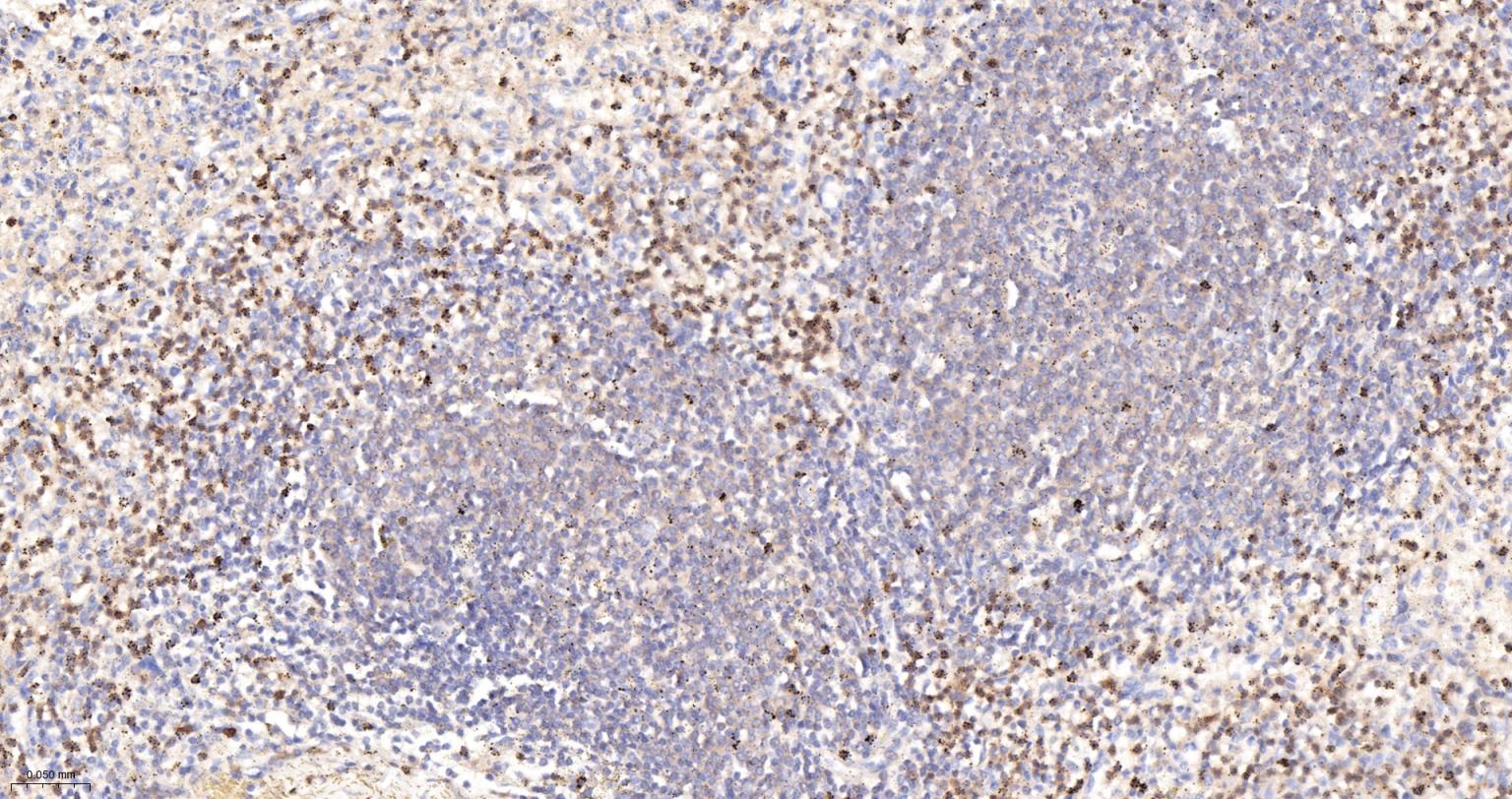 葡萄糖-6磷酸脱氢酶重组兔单抗