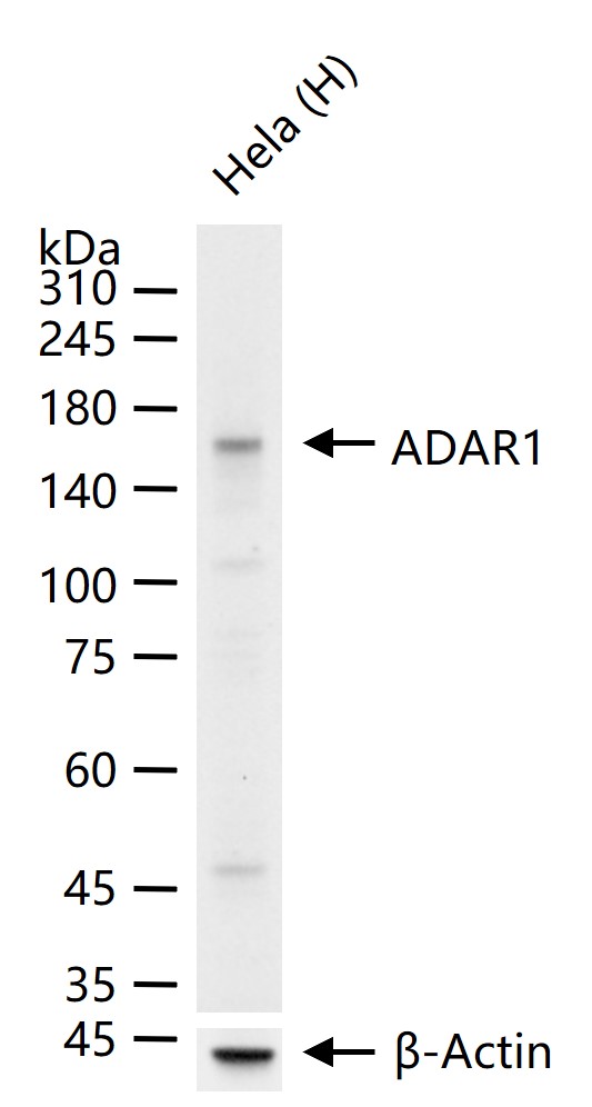 双链RNA腺苷酸脱氨基酶重组兔单抗